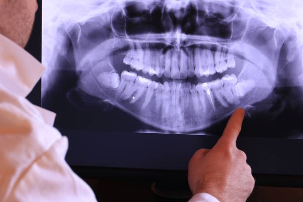 Best Emergency Treatment for Toothache in Rolling Hills Estates, CA